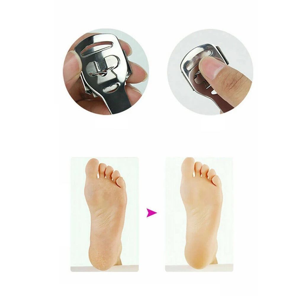 Foot care Callus & Corn shaver