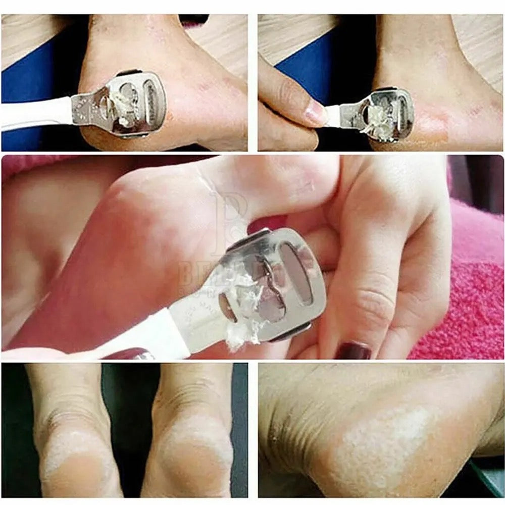 Foot care Callus & Corn shaver