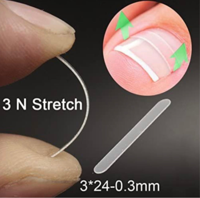 Toenail Straightening - 12pcs